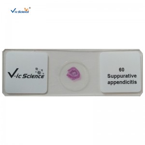 100db készlet emberi patológia csúszik mikroszkopikusan elkészített tárgylemezeket