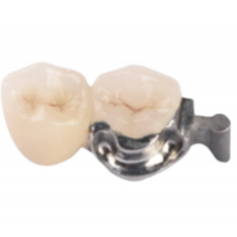 Pontossági rögzítés